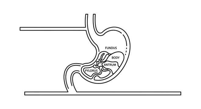 Diagram of the human stomach anatomy with labeled sections: fundus, body, antrum, pylorus
