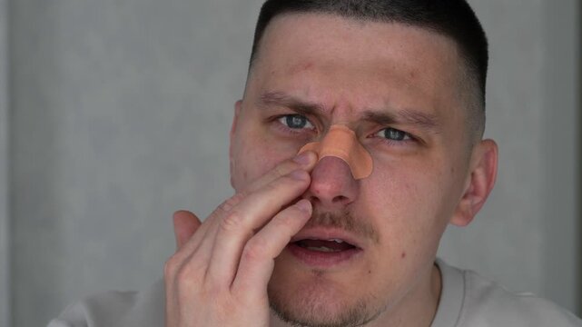 A man with a broken nose and a bandage on the bridge.
Deviated septum.
Face, medical bandage, rhinoplasty, plastic surgery