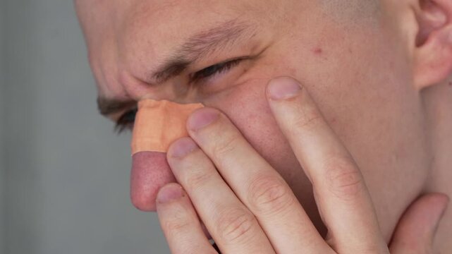 A man with a broken nose and a bandage on the bridge.
Deviated septum.
Face, medical bandage, rhinoplasty, plastic surgery