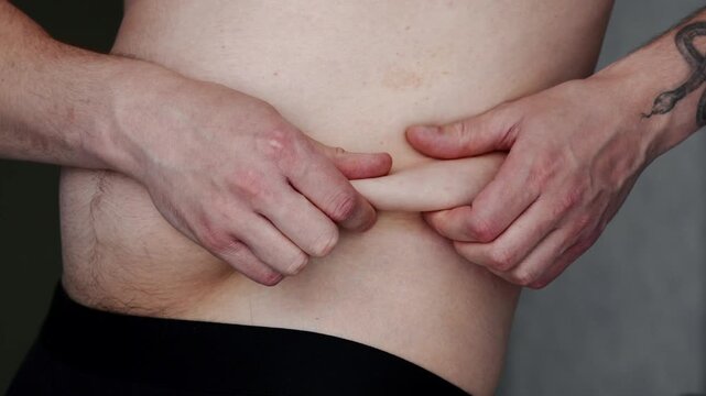 A fat belly in a man.
Excess weight and obesity due to poor diet and lifestyle.