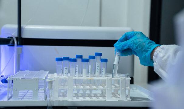 Lab work, scientists holds a test tube takes the test from a test tube in analysis for vaccine development.
