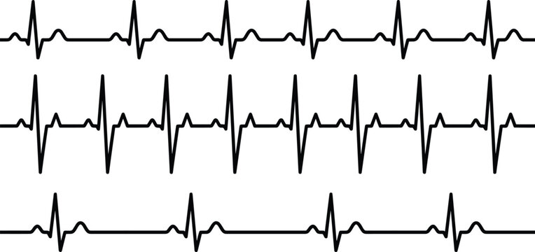 Medical Heartbeat Cardiogram Vector Set with Normal Tachycardia and Bradycardia ECG EKG Line Art Rhythms for Healthcare Hospital and Diagnostic Infographics