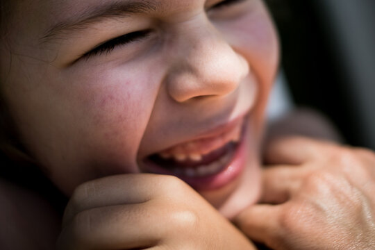 A tight close-up shot of a young boy squinting his eyes and laughing out loud, showing his missing milk teeth during a bright summer day.