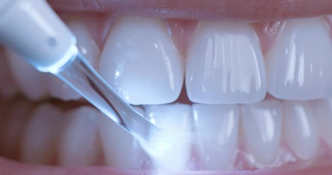 Dental water flosser cleaning plaque from teeth. 4K Video. Slow-motion water flosser jet cleaning between healthy teeth. Advanced oral hygiene.
