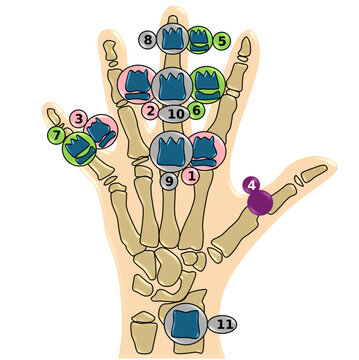 Skeletal Maturity Assessment and Dental Age Correlation Map