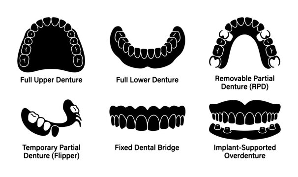 Dental Prosthetics Vector Icons: Full Dentures, Partial Dentures, Dental Bridges, and Overdentures for Oral Health and Dentistry Concepts