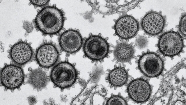 Transmission electron micrograph of coronavirus particles with surface spikes