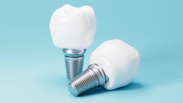 Dental implant model. A concept of implantation teeth and dental surgery. 3d rendering.
