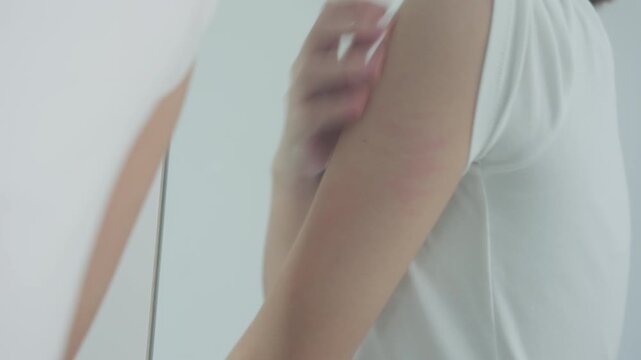 skin problem and beauty. Young woman scratch body has itchy skin from skin allergic, steroid allergy, sensitive skin, red from sunburn, chemical allergy, rash, insect bites, Seborrheic Dermatitis.