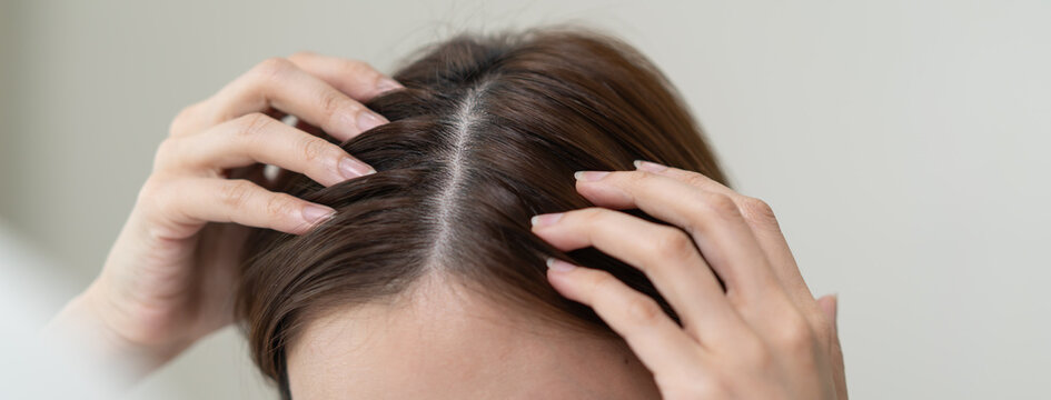 problem hair fall asian young woman, girl worry about balding, looking at scalp in mirror, hand in break into front hair loss, thin problem.