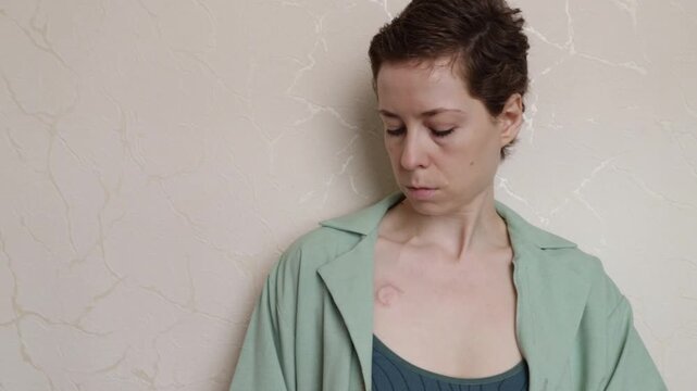 portrait of a cancer survivor with a visible chemotherapy port and neutral expression, representing oncology recovery, resilience and living with treatment changes