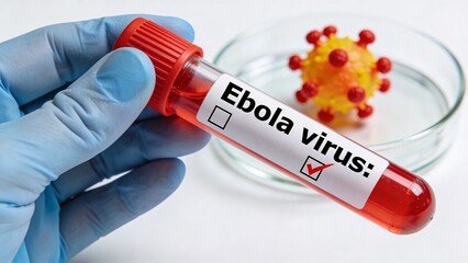 Obraz premium Ebola Virus medical test tube with blood sample, laboratory analysis and microscopic view of virus structure in petri dish, medical research and diagnosis