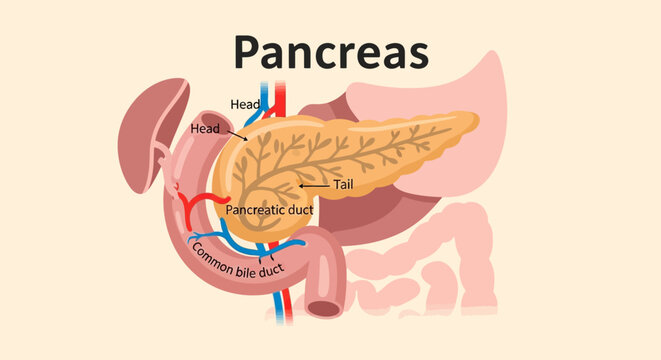 Anatomical diagram of the human pancreas showing head, tail, and pancreatic duct.
