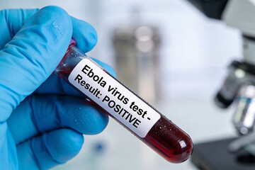Fototapeta premium Scientist wearing blue glove holding test tube with positive Ebola virus blood sample. Medical diagnosis of dangerous disease during epidemic or war. Laboratory background for research.