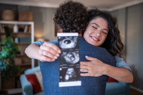 Happy couple embracing, announcing pregnancy with sonogram