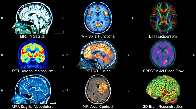 Medical Brain Imaging Montage: A detailed montage showcasing various advanced medical brain imaging techniques, including MRI, PET, SPECT, and DTI.