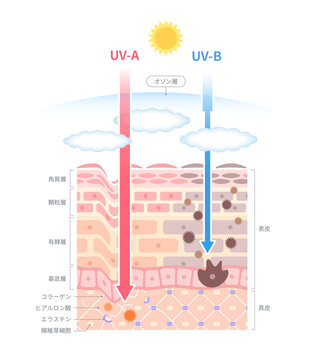 UVAとUVBの紫外線ダメージがオゾン層を突き抜けて肌にダメージを与えている肌断面図イラスト