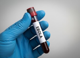 Obraz premium Ebola Blood Sample in Laboratory Hand with Blue Glove