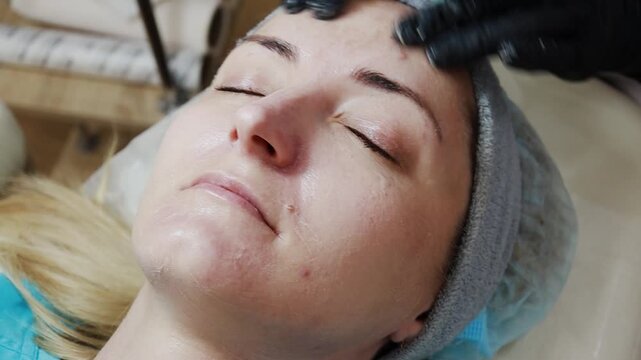 A female doctor, a professional cosmetologist, prepares a patient's face for a procedure