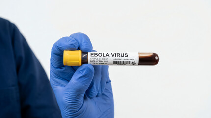Obraz premium ​A scientist in blue gloves holding a positive Ebola virus blood sample test tube against a white background.