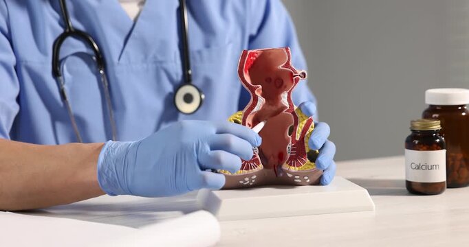 Doctor showing model of unhealthy lower rectum with inflamed vascular structures at light wooden table in clinic, closeup