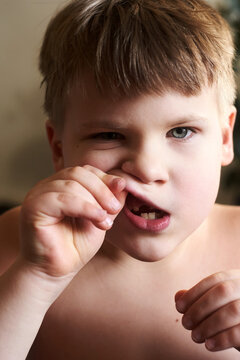 Lost Front Tooth