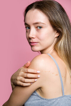 Woman Touching Shoulder