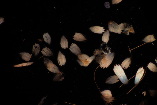 Micrograph of Butterfly Wing Scales