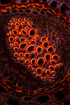Micrograph of Plant Stem Parenchyma Cells