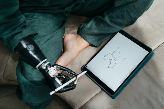 Innovative Drawing With a Prosthetic Hand in a Cozy Setting
