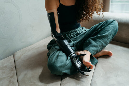 Embracing Innovation With a Modern Prosthetic Arm at Home