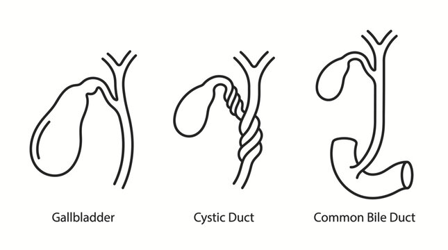 Anatomical line art illustration showing the gallbladder, cystic duct, and common bile duct structures.