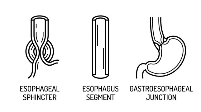 Medical illustration showing the anatomy of the esophagus and gastroesophageal junction in a simple line art style.