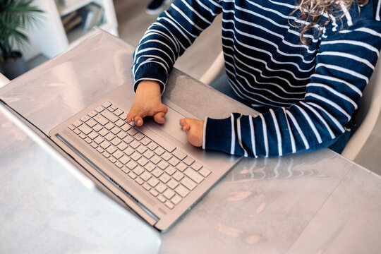 Person with limb difference typing on laptop