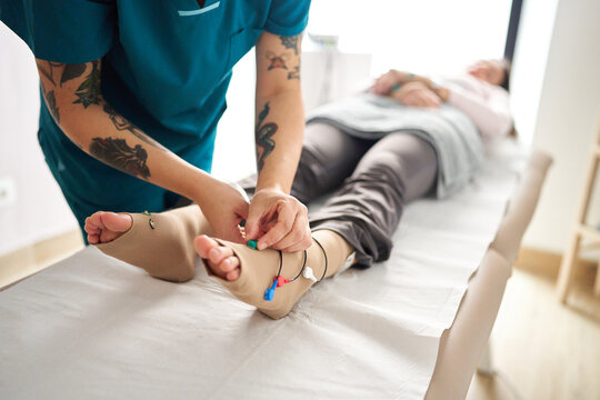 Therapist applying neurostimulation electrodes to patient's leg