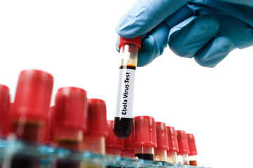 Naklejka premium Ebola Virus Blood Test Sample, A technician's gloved hand lifts an Ebola Virus Test blood tube from a laboratory rack for infection screening and analysis
