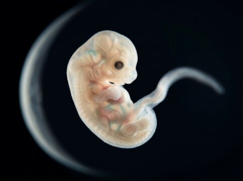 Human embryo at 7 weeks of development, closeup view showing early formation of limbs and facial features