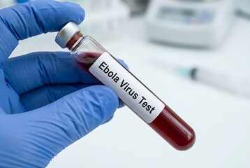 Naklejka premium Hand wearing blue nitrile glove holds blood sample test tube labeled Ebola Virus Test, medical laboratory, scientific research, diagnostics, health and safety.