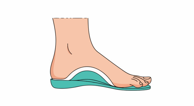 Simplified cross-section of a human foot with an orthopedic insole