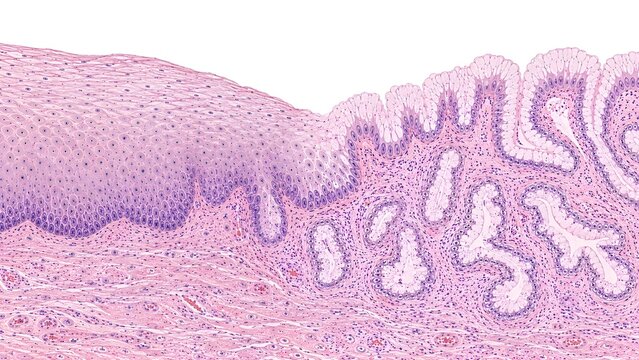 Medical Histology Comparison of Ectocervical and Endocervical Epithelium.