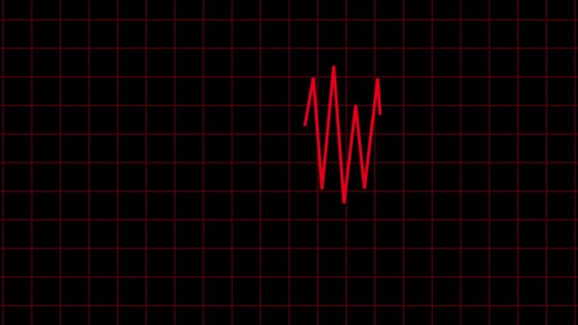 Heartbeat flatline electrocardiogram, Medical concept of a heartbeat waveform fading to a flatline on black background representing.