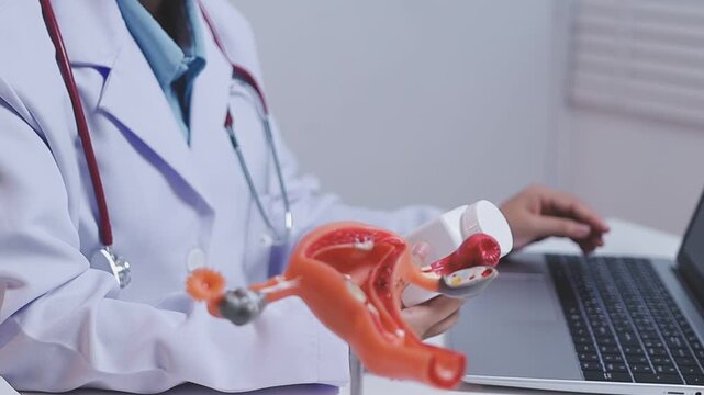 Doctor holding human uterus model for vaginal and cervix pap smear check up in the obstetrics and gynecology.