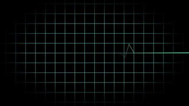 Heartbeat Flatline Purple cardiograph recording animation showing heartbeat flatline in 4K video quality, ideal for medical monitoring visuals, emergency concepts, and healthcare video backgrounds