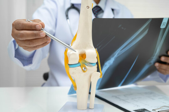 Doctor examining knee joint bone radiography xray film.