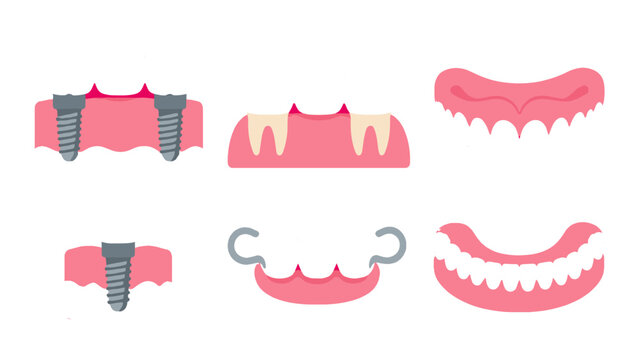 Dental implant and denture set with teeth and gums icons