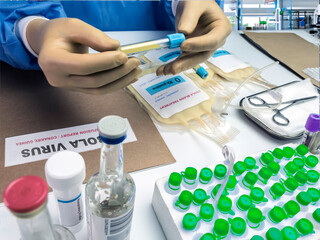Fototapeta premium Blood plasma containing antibodies prepared for a patient infected with the Ebola virus, studio recreation, conceptual image