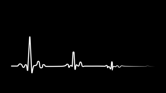 Damped Waveform Animation Set &ndash; Signal Fade Out Oscillation in Black Red Green Colors Set. White, green, blue, red on black background	