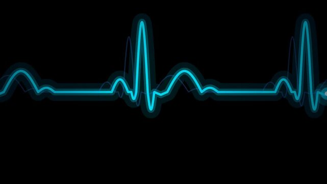 ECG neon cyan pulse animated full width seamless loop alpha