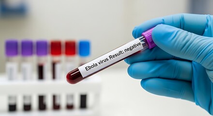 Fototapeta premium Medical wearing blue nitrile gloves holding a test tube labeled ebola virus result negative with a rack of samples in background