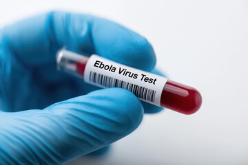 Obraz premium Hand in Blue Medical Glove Holding Ebola Virus Test Tube with Red Fluid on White Background